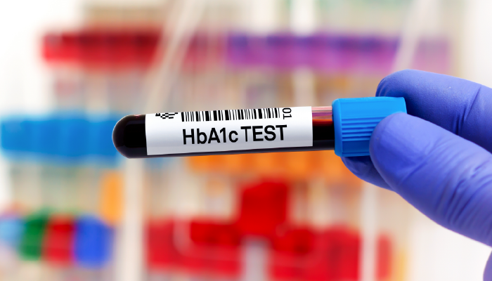 What’s the Role of HbA1C in the Diagnosis of Diabetes?