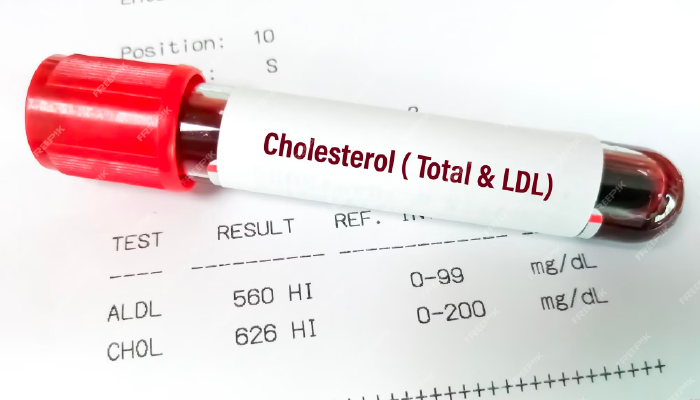Things That Can Raise Your Cholesterol Levels