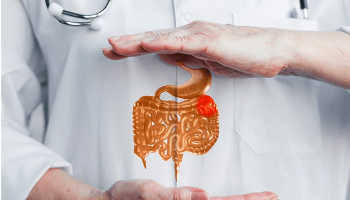 Gallstone Diagnosis: How Do Doctors Determine if You Have Gallstones
